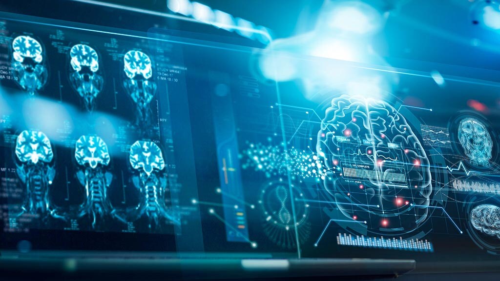 AI in medical imaging is transforming how healthcare professionals diagnose and treat patients. Through advanced algorithms, AI can detect patterns and anomalies in medical scans that might be missed by the human eye, enabling early detection of diseases. This technology supports radiologists by automating routine tasks, freeing up time for more complex assessments. Additionally, AI-driven imaging helps reduce diagnostic errors, improve patient outcomes, and streamline workflows, ultimately contributing to more precise and efficient medical care.